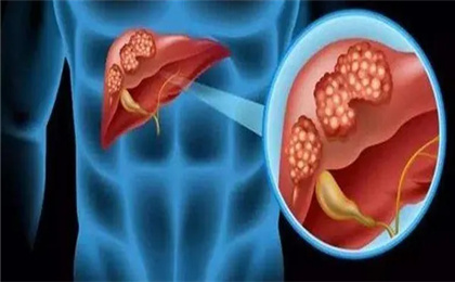 肝脏干细胞.jpg