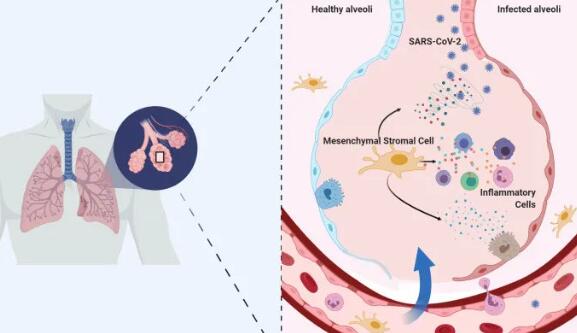 快讯！自体脂肪间充质干细胞治疗新冠肺炎后遗症方案在日本获批