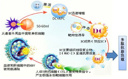 现代医学新支柱——什么是免疫细胞治疗（癌症患者的新希望）