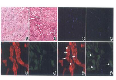 骨髓间充质干细胞治疗猪急性心肌梗死效果的实验研究