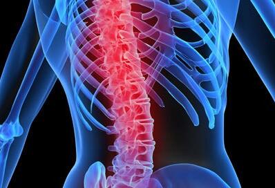 输注自体骨髓干细胞治疗脊髓损伤，13例病人获得一系列改善