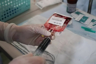 造血干细胞是怎么采集的？