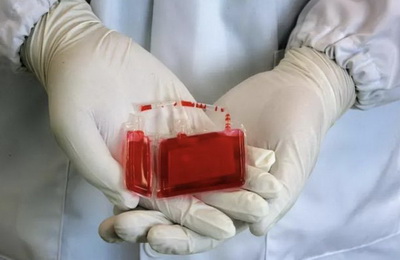 捐献造血干细胞会对身体造成伤害吗？（造血干细胞的来源）