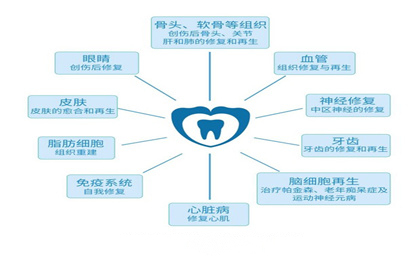 牙髓干细胞注射液可治疗牙周炎（牙髓干细胞治疗优势）