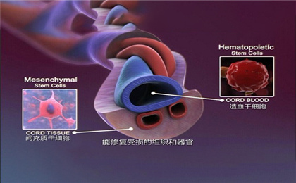 傻傻分不清楚？脐带血造血干细胞和脐带间充质干细胞的区别