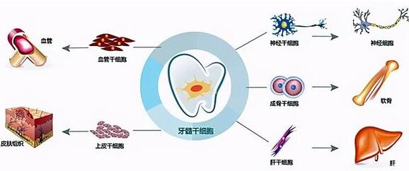 牙髓干细胞治疗银屑病的临床研究与原理