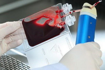 捐献脐带血有什么风险吗？（脐带血自存有意义吗）