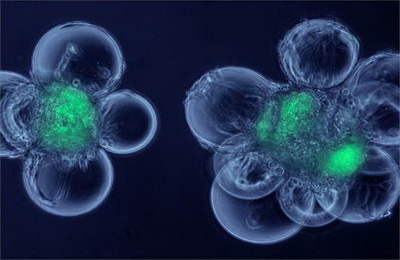 为什么胚胎干细胞可以治病（胚胎干细胞治疗的原理和方法）