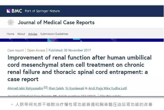 研究证明：干细胞有效改善肾功能挽救肾衰竭