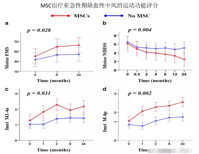 MSC间充质干细胞治疗缺血性中风的临床研究