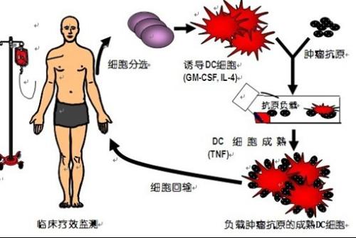 细胞免疫疗法有什么优势（细胞免疫治疗会有什么副作用）