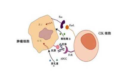 CIK细胞在生物细胞免疫治疗中的应用